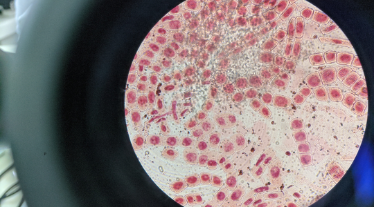 The Stem Cell Excuse: Why Retinol Advocates Might Be Missing the Bigger Picture